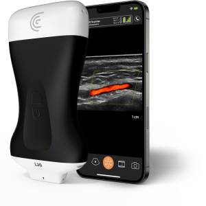 Maquina de Ultrasonido POC